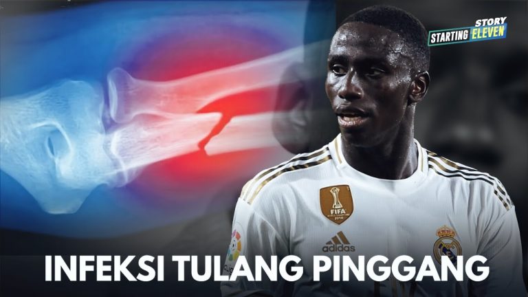 Kelumpuhan & Kursi Roda Yang Membawa Ferland Mendy Ke Real Madrid